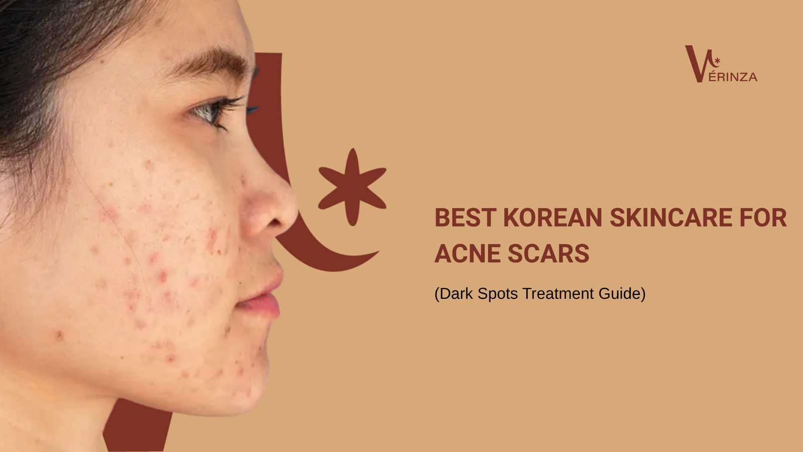 korean skincare for acne scars