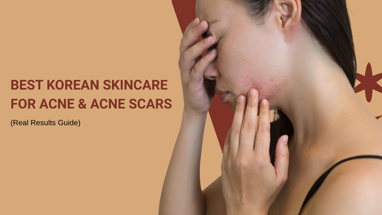 korean skincare for acne