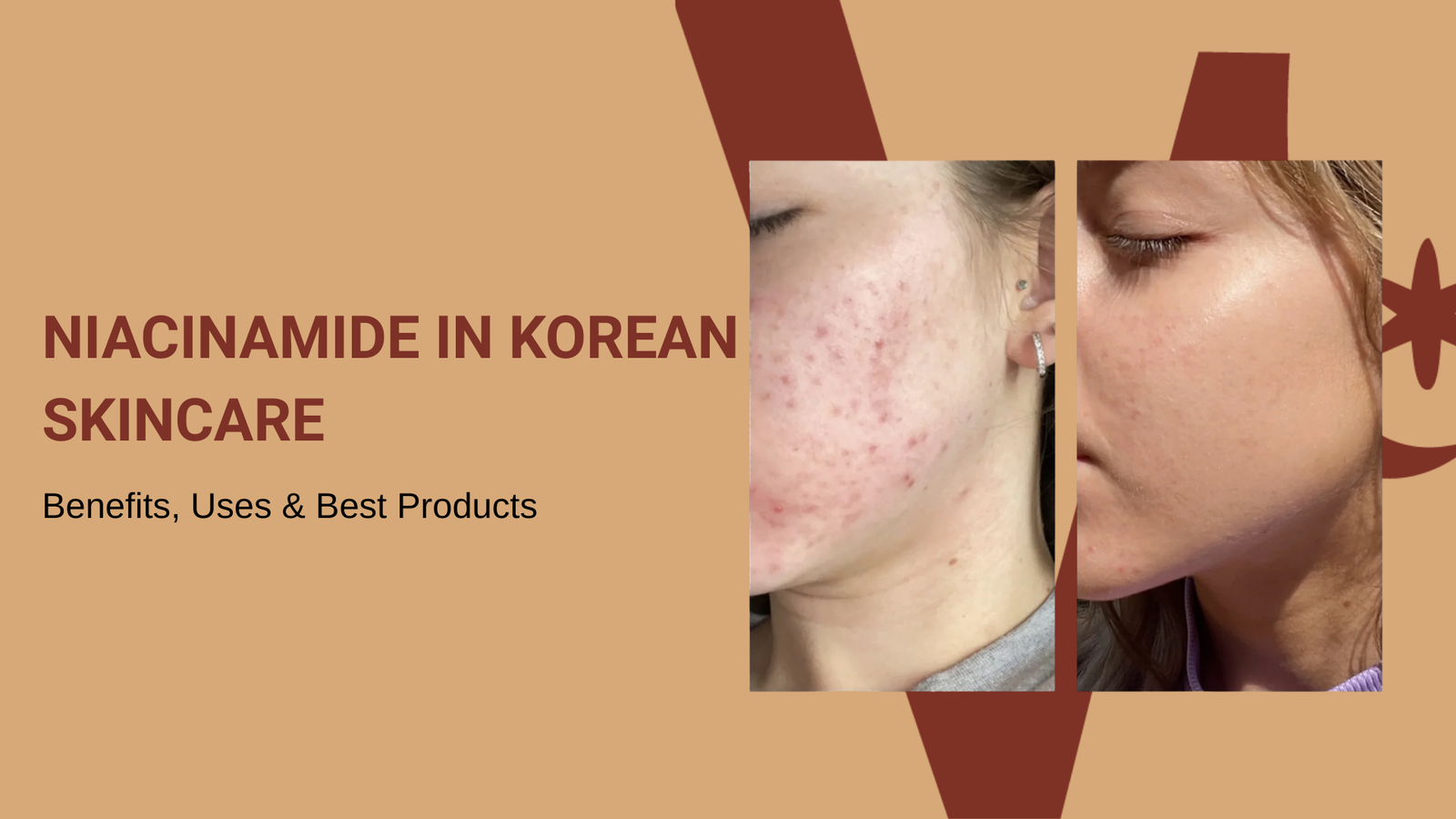 niacinamide korean skincare