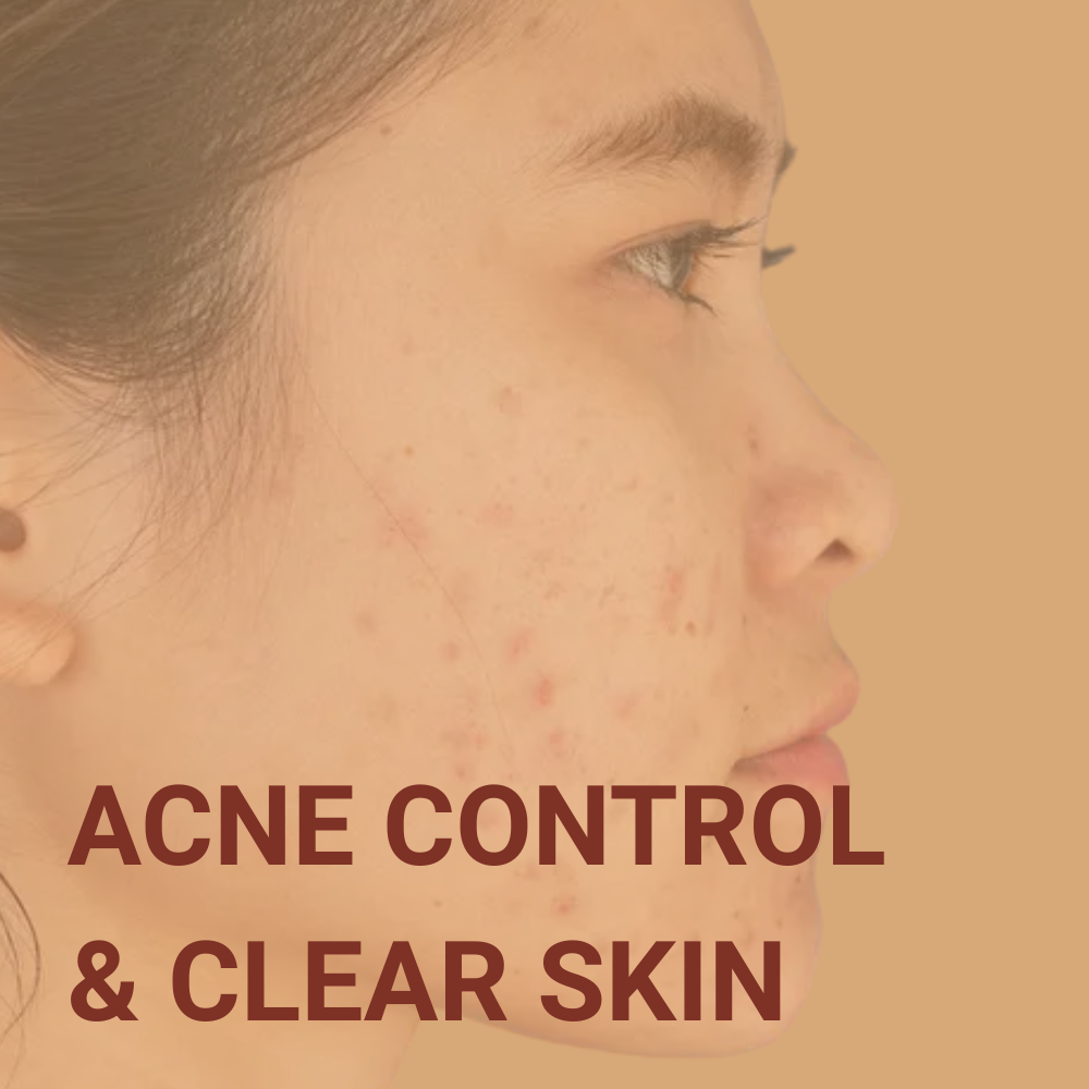 Acne & Breakouts