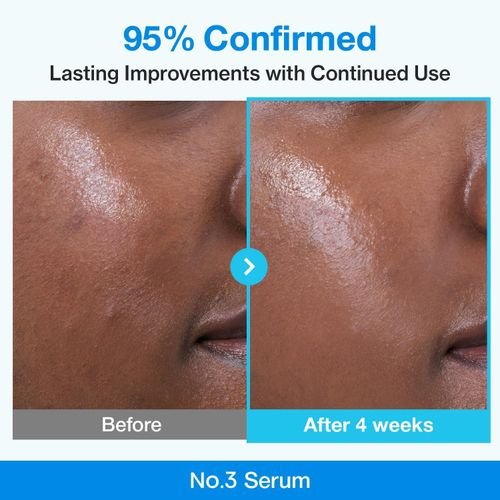 Numbuzin Blue Bio-Retinol Pore Refining Serum