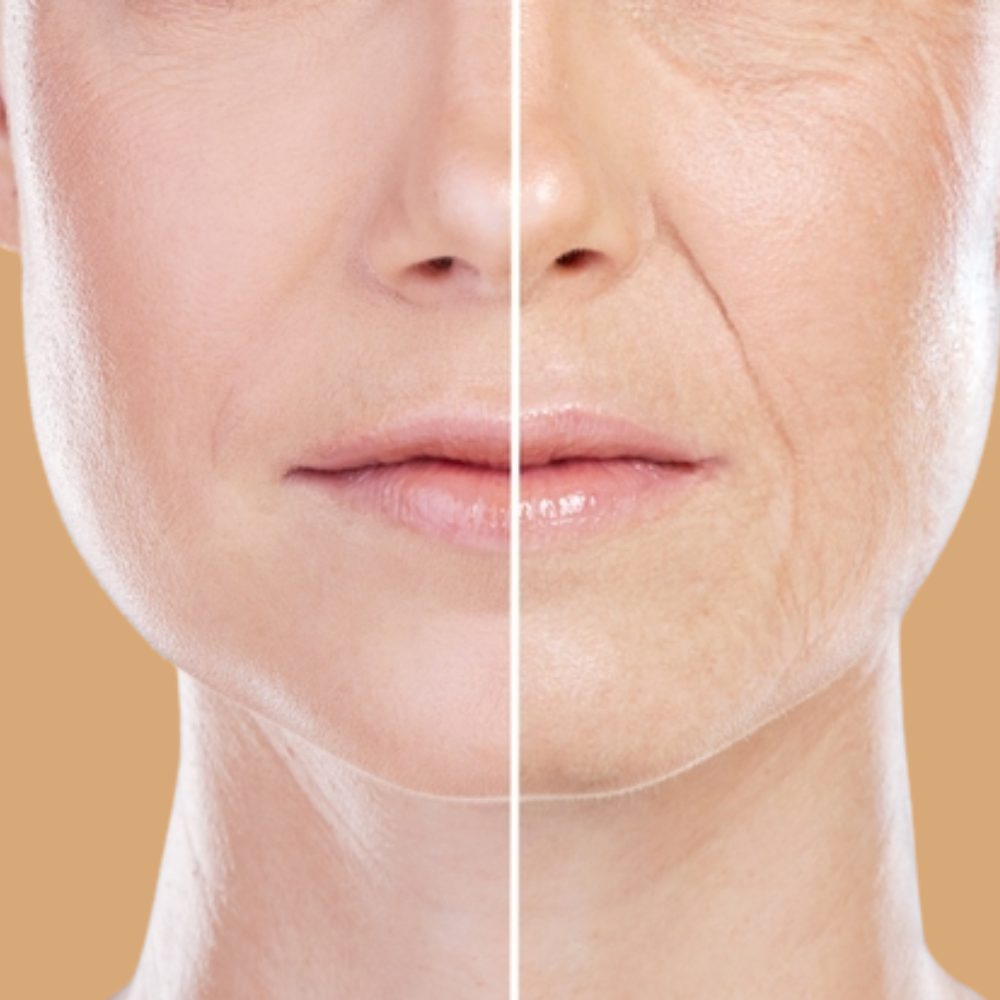 Anti-Aging & Wrinkles